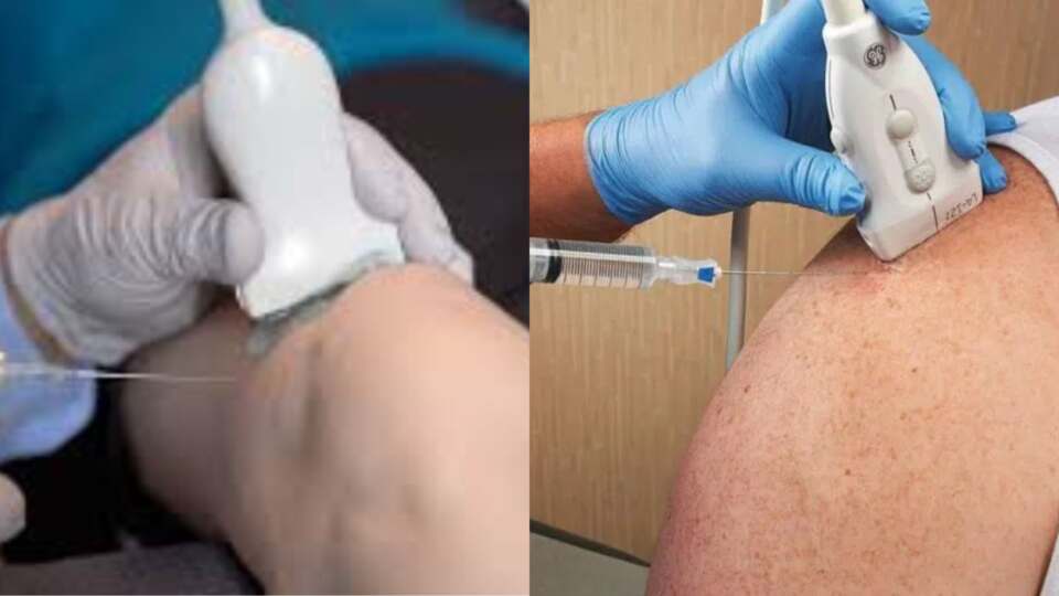 Returning Strength to Motion: Exploring Cortisone Injection Options in Agoura Hills