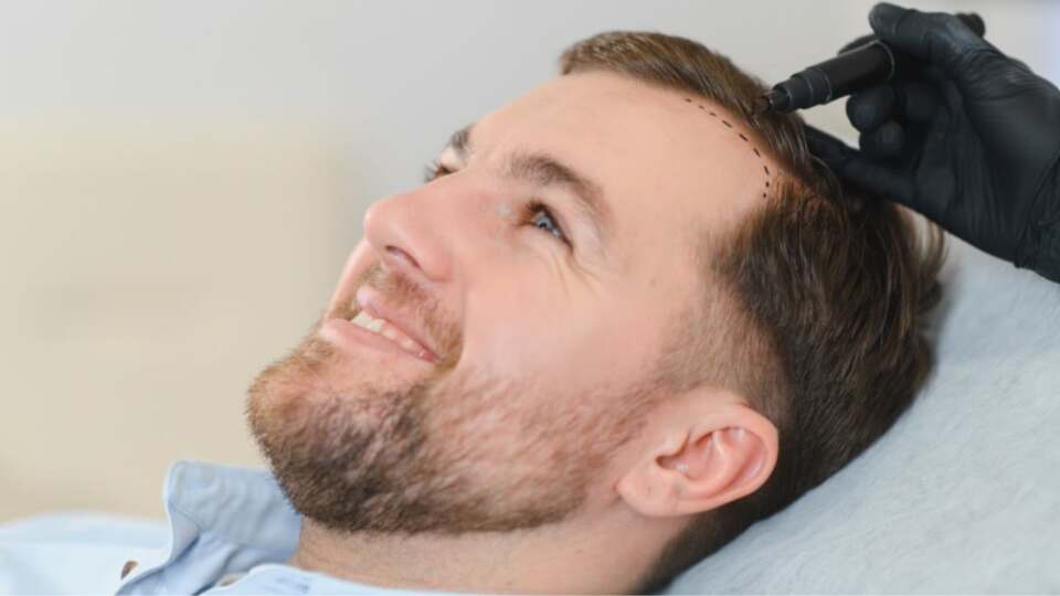 Tattooing Your Hairline The Simple Solution to Thinning Hair