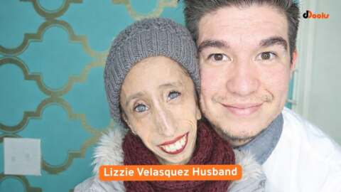 Lizzie Velasquez’s Husband What We Actually Know About Her Personal Life